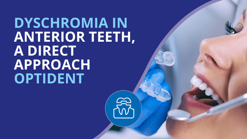 White Dental Beauty Case: Dyschromia In Anterior Teeth, A Direct Approach By Monaldo Saracinelli