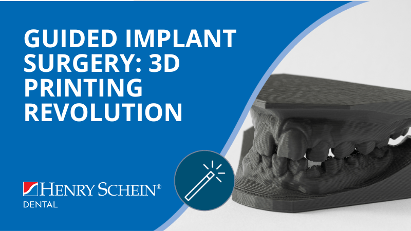 Guided Implant Surgery - 3D Printing Revolution