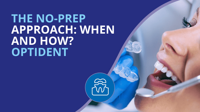 White Dental Beauty Case: The No-prep Approach. When And How? By Stefan Koubi